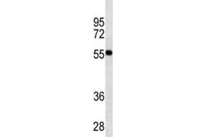 VDR antibody western blot analysis in MDA-MB453 lysate. (Vitamin D Receptor antibody)