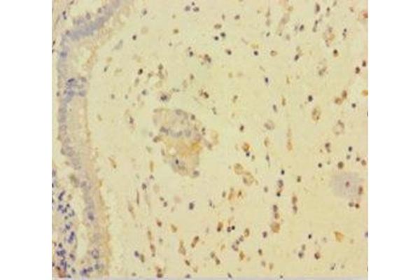 RARRES3 antibody  (AA 1-133)