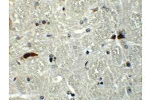 Immunohistochemistry (IHC) image for anti-RAB Guanine Nucleotide Exchange Factor (GEF) 1 (RABGEF1) (C-Term) antibody (ABIN1030611) (RABGEF1 antibody  (C-Term))