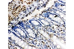 IHC-P: Lamin B2 antibody testing of rat intestine tissue