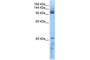 Image no. 1 for anti-RecQ Protein-Like 5 (RECQL5) (AA 431-480) antibody (ABIN6736603) (RECQL5 antibody  (AA 431-480))