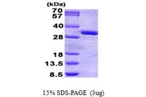 Image no. 1 for Phosphatase, Orphan 1 (PHOSPHO1) protein (His tag) (ABIN1098548) (PHOSPHO1 Protein (His tag))