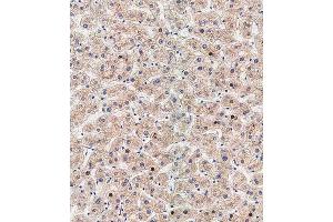 Immunohistochemical analysis of paraffin-embedded human liver tissue using (ABIN388518 and ABIN2849631) performed on the Leica® BOND RXm. (ATG5 antibody  (N-Term))