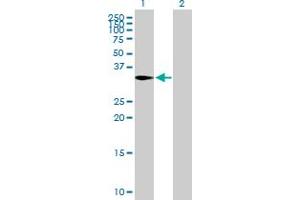 Western Blot analysis of CAPZA2 expression in transfected 293T cell line by CAPZA2 MaxPab polyclonal antibody. (CAPZA2 antibody  (AA 1-286))