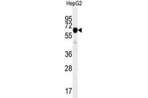 IGF2BP2 Antibody (C-term) western blot analysis in HepG2 cell line lysates (35µg/lane). (IGF2BP2 antibody  (C-Term))