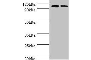 Western blot All lanes: Cytosolic 10-formyltetrahydrofolate dehydrogenase antibody at 8 μg/mL Lane 1: Mouse liver tissue Lane 2: Mouse gonad tissue Secondary Goat polyclonal to rabbit IgG at 1/10000 dilution Predicted band size: 99, 88, 100, 56 kDa Observed band size: 99 kDa