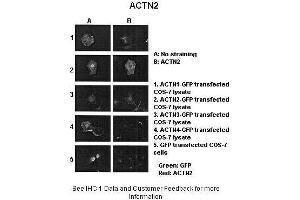 Sample Type :  ACTNX-GFP transfected COS-7 cells  Primary Antibody Dilution :  1:1000  Secondary Antibody :  Anti-rabbit-Alexa-Fluor 568  Secondary Antibody Dilution :  1:100  Color/Signal Descriptions :  Green: GFP Red: ACTN2  Gene Name :  ACTN2  Submitted by :  Johannes W. (ACTN2 antibody  (N-Term))