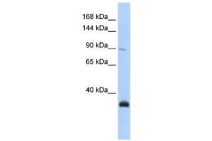 MORC3 antibody used at 1 ug/ml to detect target protein.