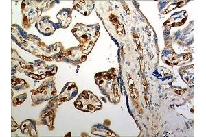 Immunohistochemistry (IHC) image for anti-Chemokine (C-C Motif) Receptor 6 (CCR6) (AA 1-374) antibody (ABIN1889540) (CCR6 antibody  (AA 1-374))