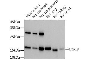 Western blot analysis of extracts of various cell lines, using (ABIN7270799) at 1:1000 dilution. (TXNDC12 antibody)