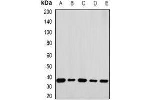 Western blot analysis of RPLP0 expression in A549 (A), K562 (B), Jurkat (C), mouse liver (D), mouse testis (E) whole cell lysates. (RPLP0 antibody)