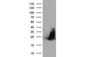 HEK293T cells were transfected with the pCMV6-ENTRY control (Left lane) or pCMV6-ENTRY FAM119A (Right lane) cDNA for 48 hrs and lysed. (FAM119A antibody)