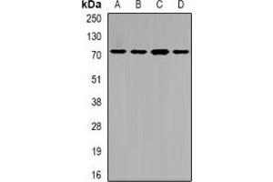 Western blot analysis of SLC22A11 expression in SW620 (A), HepG2 (B), mouse liver (C), rat kidney (D) whole cell lysates. (SLC22A11 antibody)