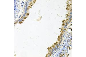 Immunohistochemistry of paraffin-embedded mouse lung using KLK11 antibody (ABIN5975048) at dilution of 1/100 (40x lens). (Kallikrein 11 antibody)