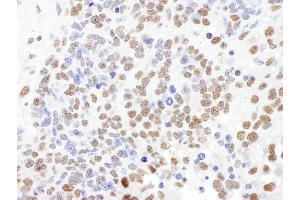 Immunohistochemistry (IHC) image for anti-Splicing Factor 1 (SF1) (AA 25-75) antibody (ABIN7453644) (Splicing Factor 1 antibody  (AA 25-75))