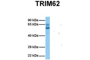 Host:  Rabbit  Target Name:  TRIM62  Sample Tissue:  Human Ovary Tumor  Antibody Dilution:  1. (TRIM62 antibody  (N-Term))