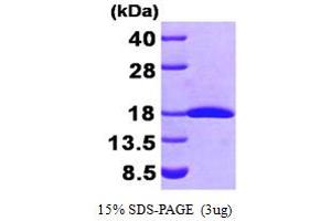 SDS-PAGE (SDS) image for Fragile Histidine Triad (FHIT) (AA 1-147) protein (His tag) (ABIN667000) (FHIT Protein (AA 1-147) (His tag))