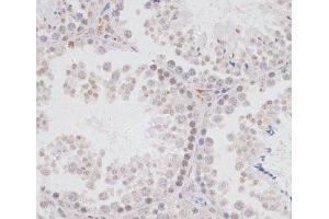 Immunohistochemistry of paraffin-embedded Mouse testis using KDM3A Polyclonal Antibody at dilution of 1:100 (40x lens). (KDM3A antibody)