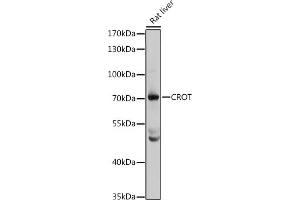 Western blot analysis of extracts of rat liver, using CROT antibody (ABIN1679365, ABIN3019208, ABIN3019209 and ABIN6220764) at 1:3000 dilution. (CROT antibody  (AA 1-87))
