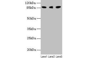 Western blot All lanes: Loxl2 antibody at 14 μg/mL Lane 1: 293T whole cell lysate Lane 2: A549 whole cell lysate Lane 3: A431 whole cell lysate Secondary Goat polyclonal to rabbit IgG at 1/10000 dilution Predicted band size: 88, 82 kDa Observed band size: 88 kDa (LOXL2 antibody  (AA 26-776))