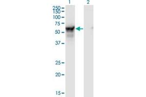 Western Blot analysis of NMT2 expression in transfected 293T cell line by NMT2 monoclonal antibody (M01), clone S1. (NMT2 antibody  (AA 1-498))