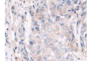 Immunohistochemistry (IHC) image for anti-Galactosidase, alpha (GLA) (AA 81-429) antibody (ABIN7431278)