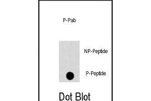 Dot blot analysis of anti-PK8-p Phospho-specific Pab (ABIN389822 and ABIN2839706) on nitrocellulose membrane. (JNK antibody  (pThr183))