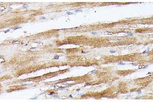 Immunohistochemistry of paraffin-embedded Rat heart using NUBP1 Polyclonal Antibody at dilution of 1:100 (40x lens). (NUBP1 antibody)