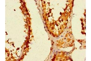 Immunohistochemistry of paraffin-embedded human testis tissue using ABIN7174763 at dilution of 1:100 (C19ORF44 antibody  (AA 101-400))