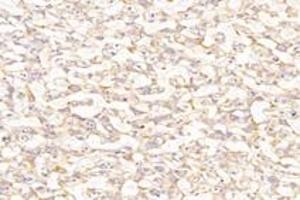 Immunohistochemistry analysis of paraffin-embedded rat placenta using,PTGFR (ABIN7075209) at dilution of 1: 800 (PTGFR antibody)