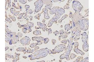 IHC analysis of ACKR2 using anti-ACKR2 antibody (ABIN6719286). (CCBP2 antibody  (AA 138-384))