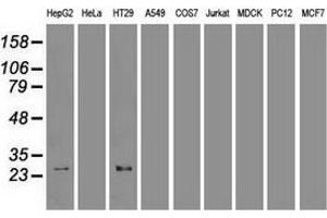 Western blot analysis of extracts (35 µg) from 9 different cell lines by using anti-HHex monoclonal antibody. (HHEX antibody  (AA 100-270))