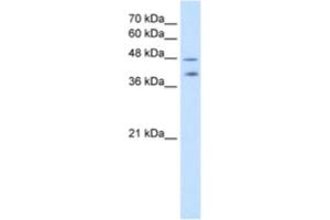 Western Blotting (WB) image for anti-Pregnancy Specific beta-1-Glycoprotein 1 (PSG1) antibody (ABIN2462567)