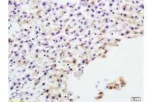 Formalin-fixed and paraffin embedded rat liver tissue labeled with Anti-AP-TNAP/ALP Polyclonal Antibody, Unconjugated  at 1:200 followed by conjugation to the secondary antibody and DAB staining (ALPL antibody  (AA 52-150))