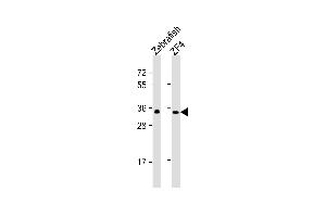 All lanes : Anti-(DANRE) gnb1 Antibody (center) at 1:1000 dilution Lane 1: Zebrafish lysate Lane 2: ZF4 whole cell lysate Lysates/proteins at 20 μg per lane. (GNB1 antibody  (N-Term))