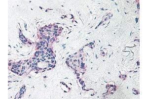 Image no. 6 for anti-Platelet Factor 4 (PF4) antibody (ABIN465152) (PF4 antibody)