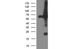 HEK293T cells were transfected with the pCMV6-ENTRY control (Left lane) or pCMV6-ENTRY DPP3 (Right lane) cDNA for 48 hrs and lysed. (DPP3 antibody)