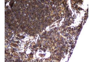 Image no. 1 for anti-Coiled-Coil Domain Containing 93 (CCDC93) (AA 293-631) antibody (ABIN1491348) (CCDC93 antibody  (AA 293-631))