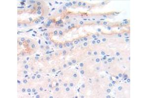 IHC-P analysis of Mouse Tissue, with DAB staining. (IL2 Receptor beta antibody  (AA 27-240))