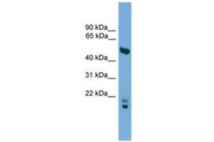 Image no. 1 for anti-Oligodendrocyte Myelin Glycoprotein (OMG) (AA 107-156) antibody (ABIN6744796) (OMG antibody  (AA 107-156))