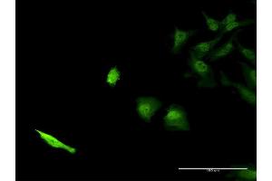 Immunofluorescence of monoclonal antibody to SEC13 on HeLa cell. (SEC13 antibody  (AA 226-324))