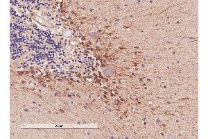 ABIN185682 (4µg/ml) staining of paraffin embedded Human Cerebellum. (COMT antibody  (Internal Region))