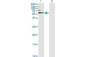 Western Blot analysis of ALB expression in transfected 293T cell line by ALB monoclonal antibody (M01), clone 1G12-1B3. (Albumin antibody  (AA 19-609))