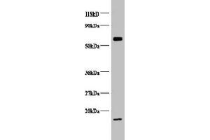 Western blot All lanes: COX5B antibody at 2 μg/mL + EC109 whole cell lysate Secondary Goat polyclonal to rabbit IgG at 1/15000 dilution Predicted band size: 14 kDa Observed band size: 14, 65 kDa (COX5B antibody  (AA 32-129))