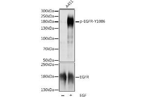 Western blot analysis of extracts of A-431 cells, using Phospho-EGFR-Y1086 antibody (ABIN7266988) at 1:1000 dilution or EGFR antibody (ABIN6127827, ABIN6139974, ABIN6139979 and ABIN7101376). (EGFR antibody  (pTyr1086))