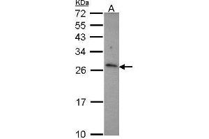 WB Image Sample (30 ug of whole cell lysate) A: JurKat 12% SDS PAGE CD27L (CD70) antibody antibody diluted at 1:1000