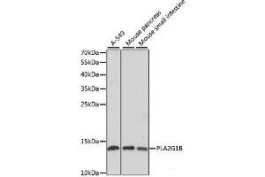 Western blot analysis of extracts of various cell lines using PLA2G1B Polyclonal Antibody at dilution of 1:1000. (PLA2G1B antibody)