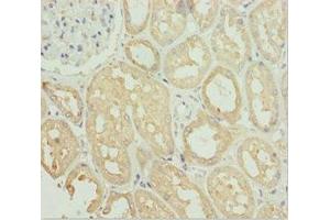 Immunohistochemistry of paraffin-embedded human kidney tissue using ABIN7171149 at dilution of 1:100 (SNAP29 antibody  (AA 1-258))