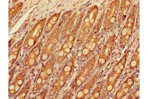 Immunohistochemistry of paraffin-embedded human small intestine tissue using ABIN7160177 at dilution of 1:100 (SLC16A9 antibody  (AA 185-304))