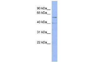 PPP2R5C antibody used at 1 ug/ml to detect target protein. (PPP2R5C antibody  (Middle Region))